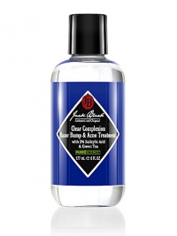 3-in-1 Clear Complexion Solution Razor Bump and Acne Treatment. An advanced, powerful, oil-free solution that offers three distinct benefits. 2% salicylic acid and lactic acid work to exfoliate the top layer of dead skin cells, unearthing the skin-trapped facial hairs that cause razor bumps and dissolving the pore clogging oils that cause acne and blackheads. Hyaluronic acid soothes skin and provides sheer, oil-free hydration to counteract dryness and irritation. 3-in-1 Clear Complexion Solution Razor Bump and Acne Treatment. An advanced, powerful, oil-free solution that offers three distinct benefits. 2% salicylic acid and lactic acid work to exfoliate the top layer of dead skin cells, unearthing the skin-trapped facial hairs that cause razor bumps and dissolving the pore clogging oils that cause acne and blackheads. Hyaluronic acid soothes skin and provides sheer, oil-free hydration to counteract dryness and irritation.
