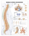 Human Spine Disorders Anatomical Chart