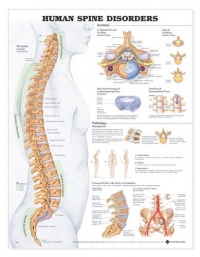 Human Spine Disorders Anatomical Chart