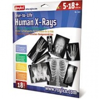 Human X-Rays on Film Human X-Rays on Film