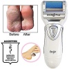 Rechargeable Emjoi Micro-Pedi Pro Foot Buffer (Special Edition)