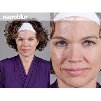Marvellous 1 Nanoblur Look up to 10 Years Younger in 40 Seconds(3ml.) Marvellous 1 Nanoblur Look up to 10 Years Younger in 40 Seconds(3ml.)