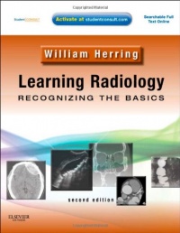 Learning Radiology: Recognizing the Basics (With STUDENT CONSULT Online Access), 2e