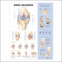 Knee Injuries Anatomical Chart Unmounted-9872PU Knee Injuries Anatomical Chart Unmounted-9872PU